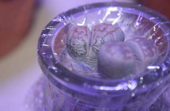 生石花怎么水培，教你四個(gè)基本步驟快速水培生根