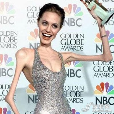 骨瘦如柴 減肥易得可怕疾病