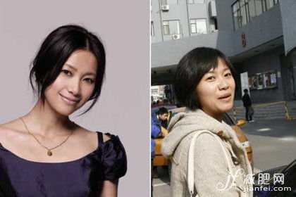 下巴，瘦臉，大S，結婚