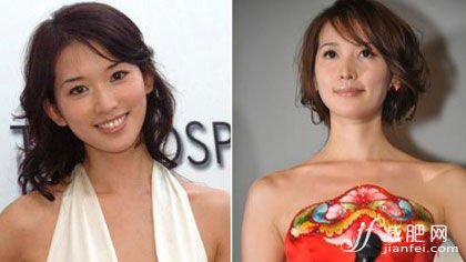 下巴，瘦臉，大S，結婚