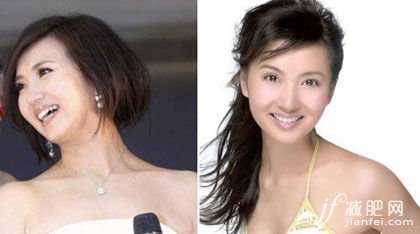 下巴，瘦臉，大S，結(jié)婚