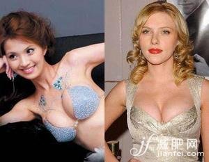 美胸，明星，塑形