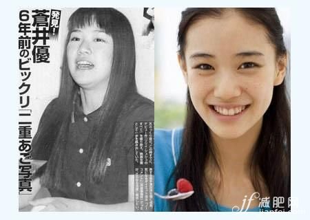 宋慧喬，劉亦菲，明星，減肥