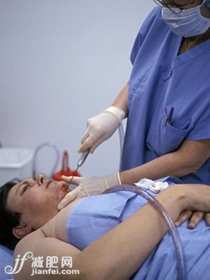 面部抽脂要謹(jǐn)慎