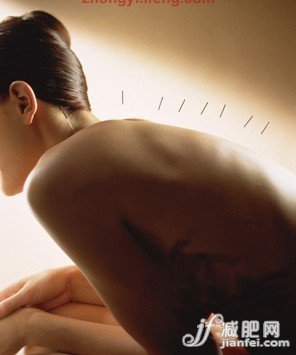 針灸減肥切勿踏入五個(gè)誤區(qū)