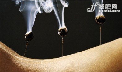 中醫(yī)針灸減肥最適宜甩啤酒肚 