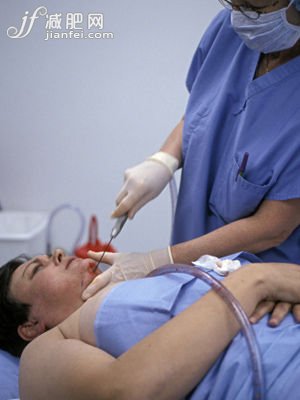 面部抽脂要謹(jǐn)慎