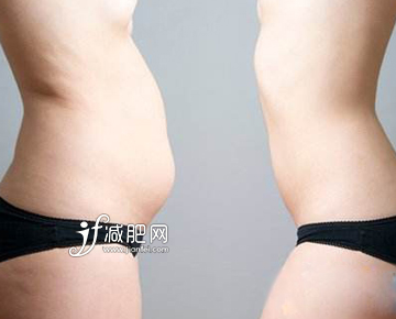 所謂的中老年變胖狀態(tài)