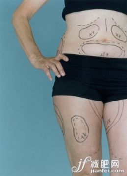 健康保健,攝影,Y50701,衣服,半裝_6294-001029_Cosmetic Surgery Markings_創(chuàng)意圖片_Getty Images China