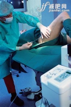 美,攝影,肖像,人,室內_imsis618-027_Woman having liposuction_創(chuàng)意圖片_Getty Images China