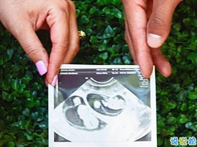 懷孕怎么發(fā)朋友圈 微信宣布懷孕的創(chuàng)意句子配圖14