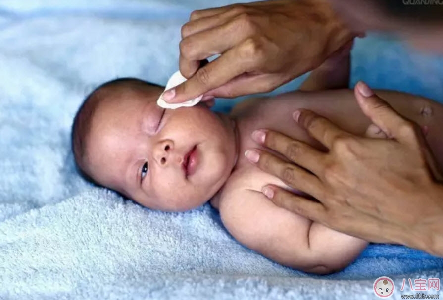 哪些孕婦易生畸形寶寶 做胎兒畸形的檢查有哪些