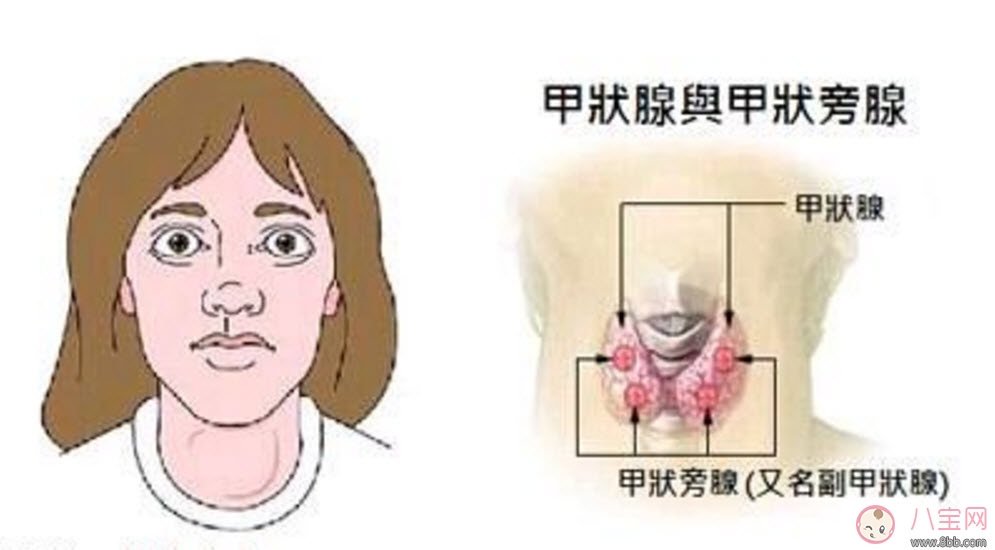 甲亢能懷孕嗎 甲亢懷孕對胎兒的影響