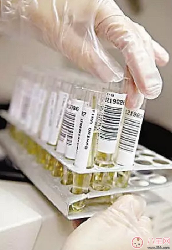 進(jìn)行驗(yàn)孕前應(yīng)該知道哪些常識(shí)性問(wèn)題 可能你還不知道