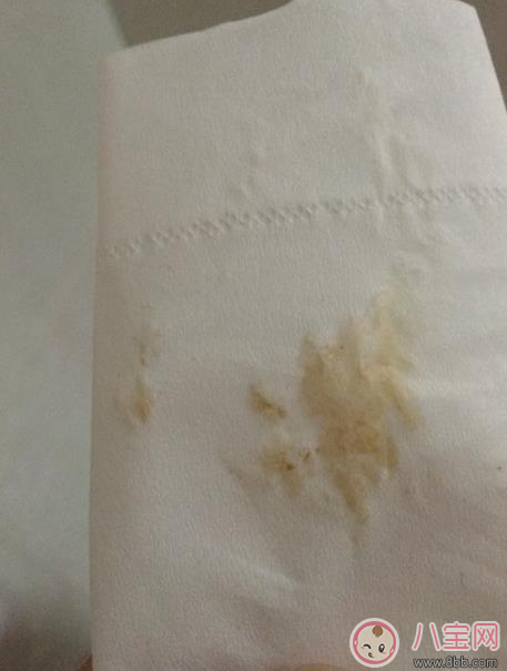 懷孕褐色分泌物是男孩 懷孕初期有褐色分泌物流出是男孩嗎