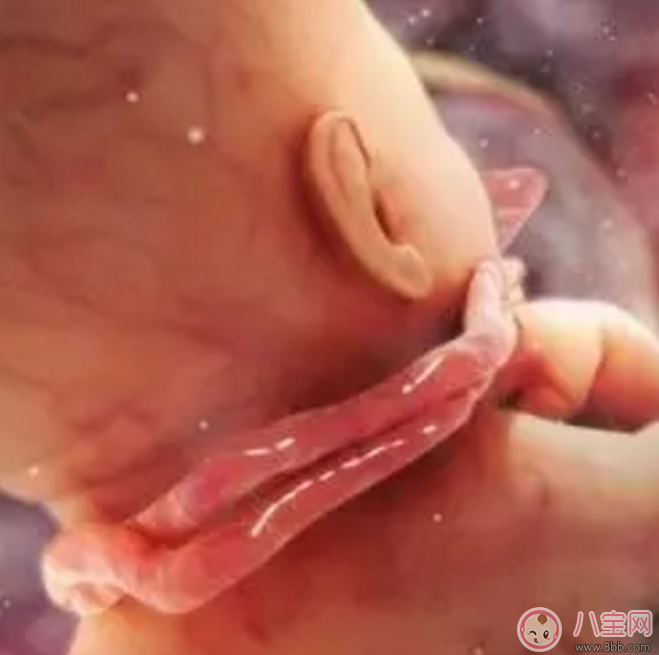 胎兒臍帶繞頸怎么辦？產(chǎn)前怎樣化解臍帶繞頸？