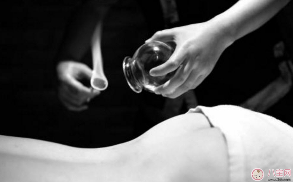 孕婦拔火罐可以嗎 孕婦肩膀能拔火罐嗎(孕婦拔過(guò)火罐怎么辦)