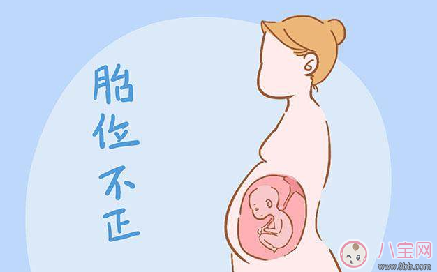 分娩是選順產(chǎn)還是剖腹產(chǎn) 醫(yī)生往往會(huì)參考這些數(shù)據(jù)