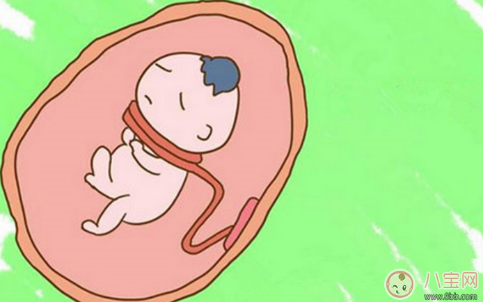 臍帶繞頸怎么辦 嬰兒臍帶繞頸嚴(yán)重嗎