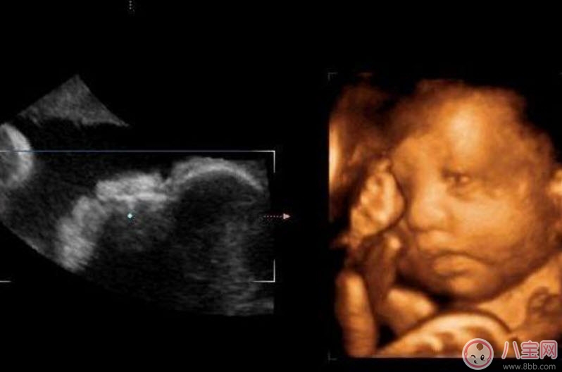 孕婦四維彩超的最佳時(shí)間 孕婦一定要做四維彩超嗎