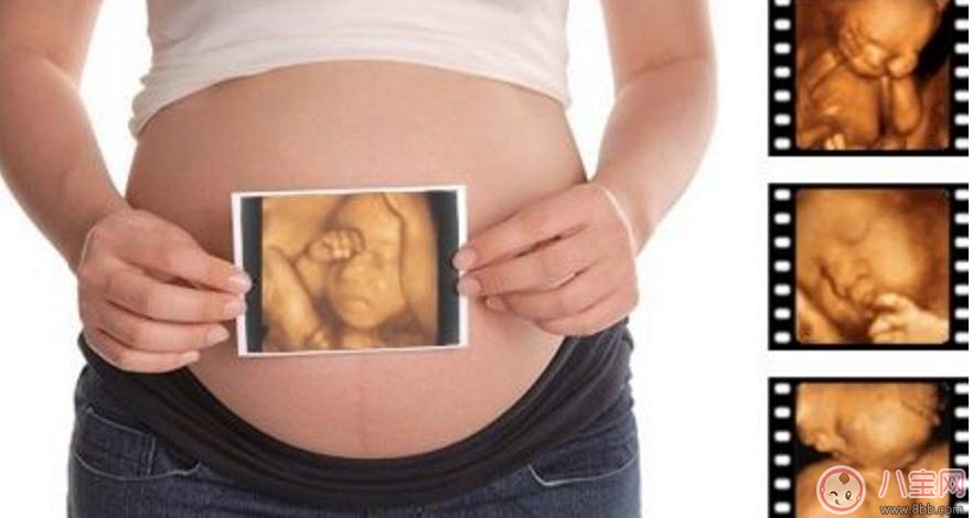 孕婦四維彩超的最佳時(shí)間 孕婦一定要做四維彩超嗎
