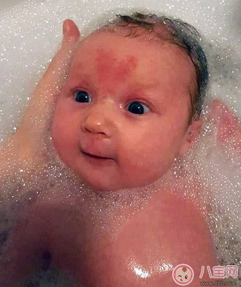 其實在懷孕的時候注意好 寶寶也會不長胎記