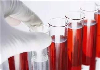 孕婦為什么要驗血型 哪些孕婦需要確定血型