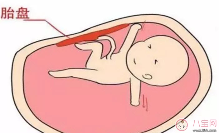 胎盤三級就已經(jīng)老化了嗎 胎盤老化判斷標準