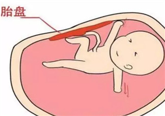 胎盤三級(jí)就已經(jīng)老化了嗎 胎盤老化判斷標(biāo)準(zhǔn)