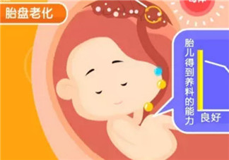 孕晚期補(bǔ)鈣會(huì)導(dǎo)致胎盤老化嗎 孕晚期補(bǔ)鈣會(huì)不會(huì)導(dǎo)致胎盤老化