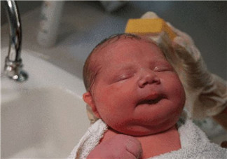 順產(chǎn)頭擠變形多久恢復(fù) 如何預(yù)防寶寶順產(chǎn)頭變形