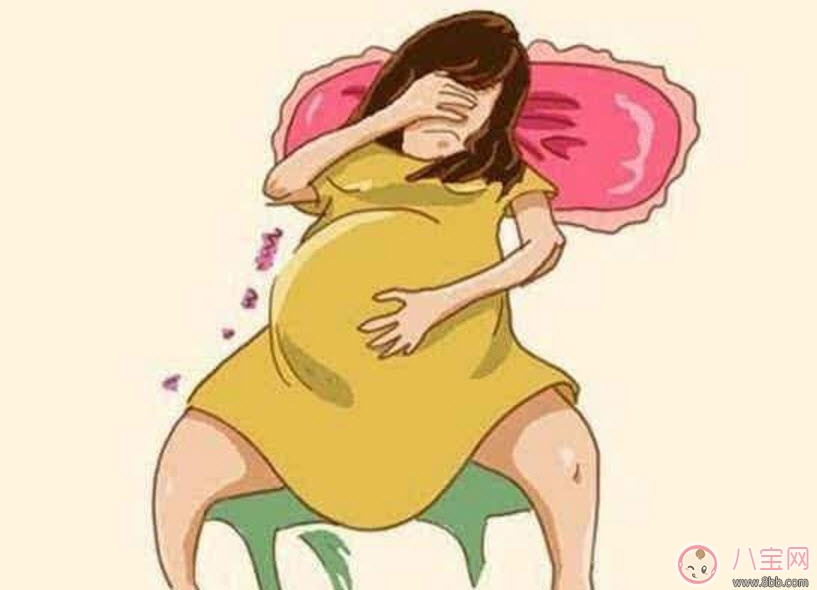 孕婦痔瘡怎么辦 孕婦痔瘡怎么治療(用什么藥) 孕婦痔瘡怎么辦 孕婦痔瘡怎么治療(用什么藥)