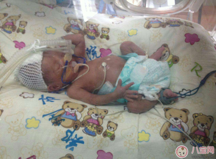 哪些準媽媽容易早產 早產準媽媽特征