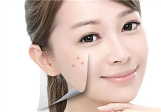 孕婦孕期長痘痘怎么辦 孕期痘痘怎么調理(長痘痘吃什么)