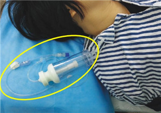 剖腹產(chǎn)的過程是怎么樣的 剖腹產(chǎn)手術前手術中手術后流程揭秘