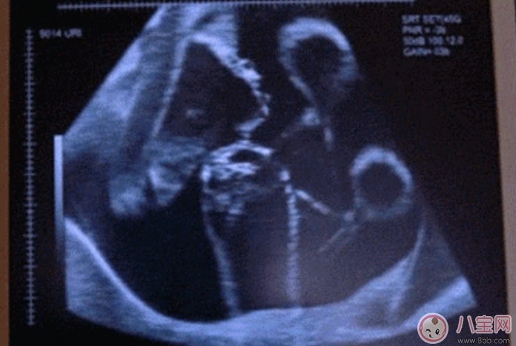 孕晚期胎動頻繁正常嗎 孕晚期胎動時間