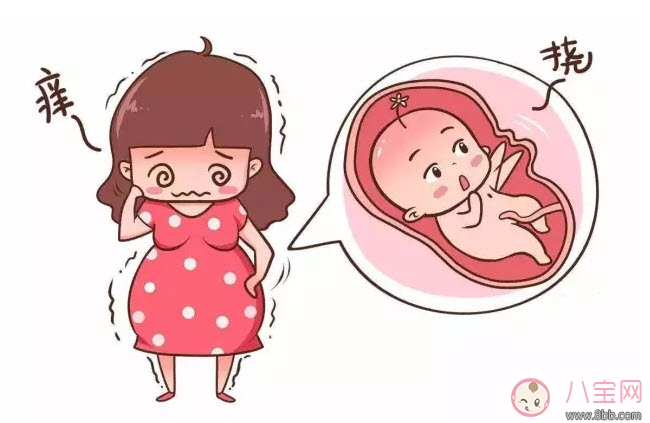 孕晚期肚皮癢怎么辦 孕晚期肚皮癢怎么緩解