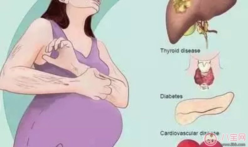 孕晚期肚皮癢怎么辦 孕晚期肚皮癢怎么緩解