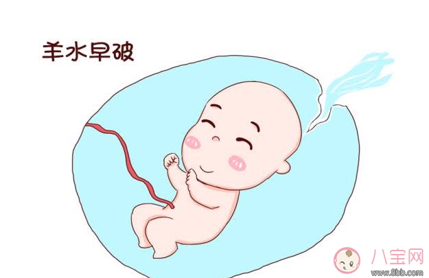 孕中期羊水早破的癥狀 如何預(yù)防羊水早破 孕中期羊水早破的癥狀 如何預(yù)防羊水早破