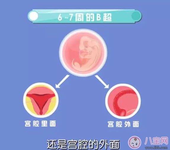 從懷孕到生要做幾次b超 懷孕做多少次b超合適(孕期b超時(shí)間表)