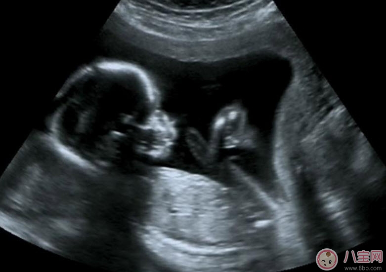 孕早期做陰道B超會(huì)影響胎兒嗎 陰式b超和b超的區(qū)別