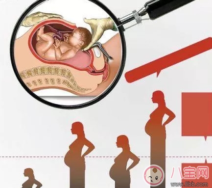 剖腹產(chǎn)孕婦會不會感到疼痛 剖腹產(chǎn)橫剖還是縱剖。