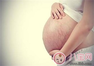 妊娠紋什么時(shí)候長(zhǎng)    怎么預(yù)防妊娠紋