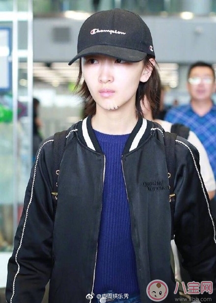 周冬雨下巴為什么會(huì)出現(xiàn)疤痕 周冬雨下巴受傷的原因