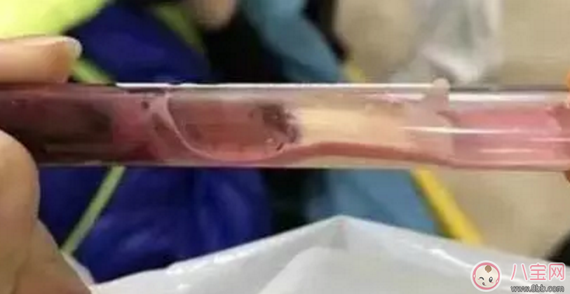 1歲男童吃西蘭花中毒 西蘭花燒制禁忌