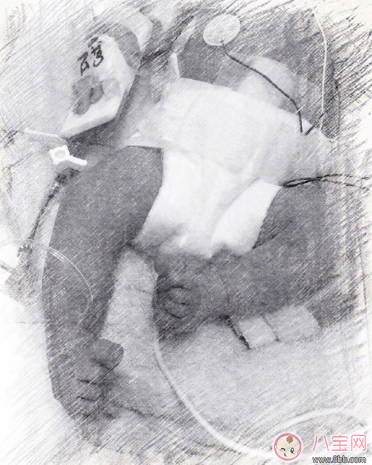 侯佩岑已經(jīng)產(chǎn)下二胎出院 為什么孩子提前出生