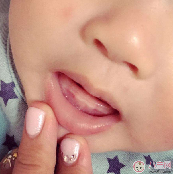 寶寶出牙怎么吃東西 寶寶出牙輔食推薦