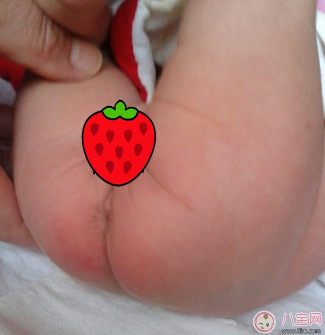 貝親護(hù)臀膏可以擦臉嗎 貝親嬰兒護(hù)臀膏能天天用嗎