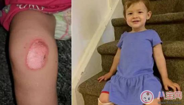 這樣居然也能燙傷 三伏天戶外兒童玩具少讓孩子玩 這樣居然也能燙傷 三伏天戶外兒童玩具少讓孩子玩