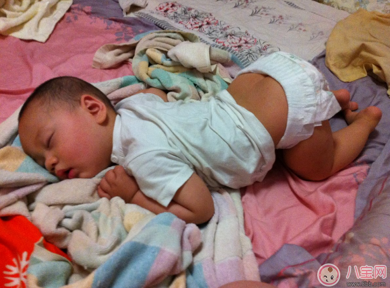 寶寶痱子總不消 用用這個(gè)準(zhǔn)會(huì)好